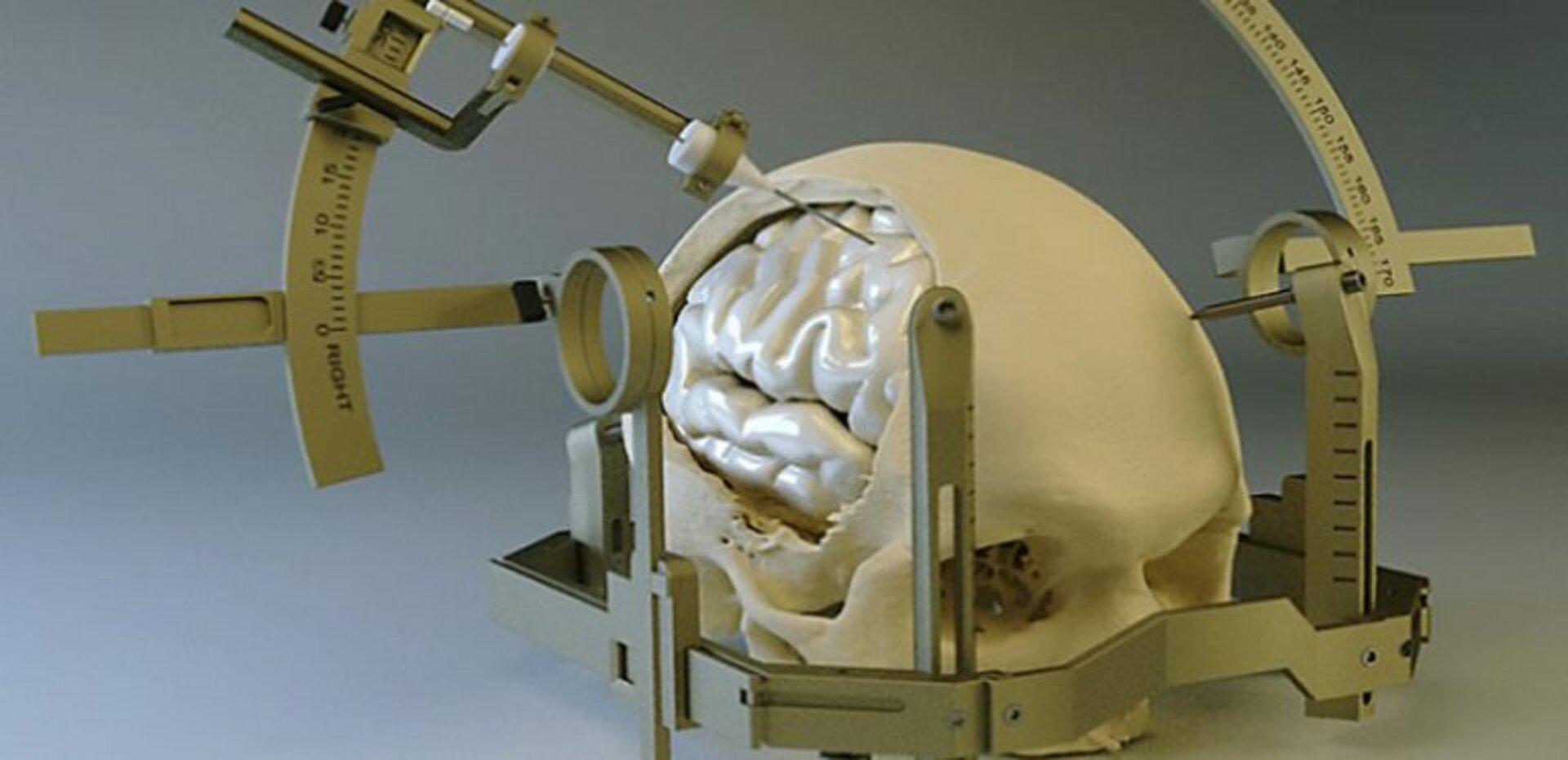 Stereotactic Surgery
